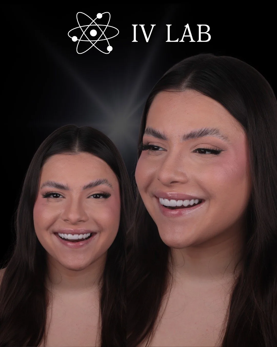 Reabilitação estética completa