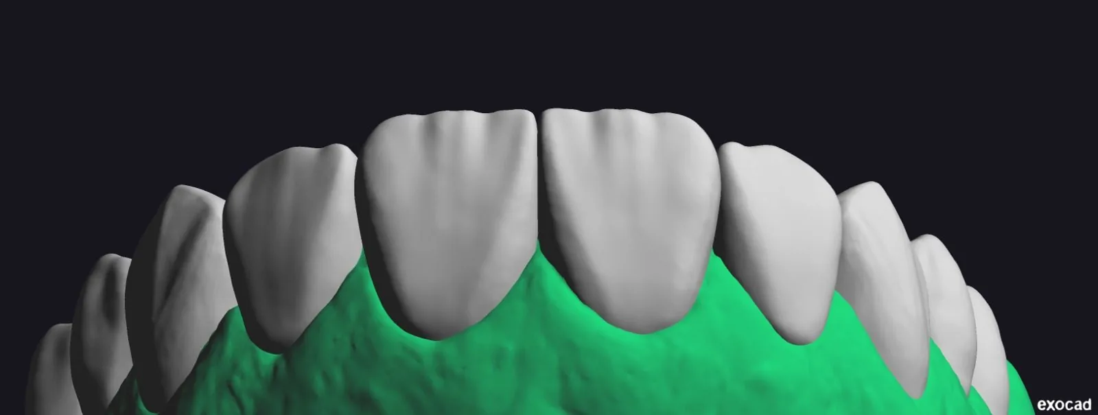 Planejamento digital do sorriso em software