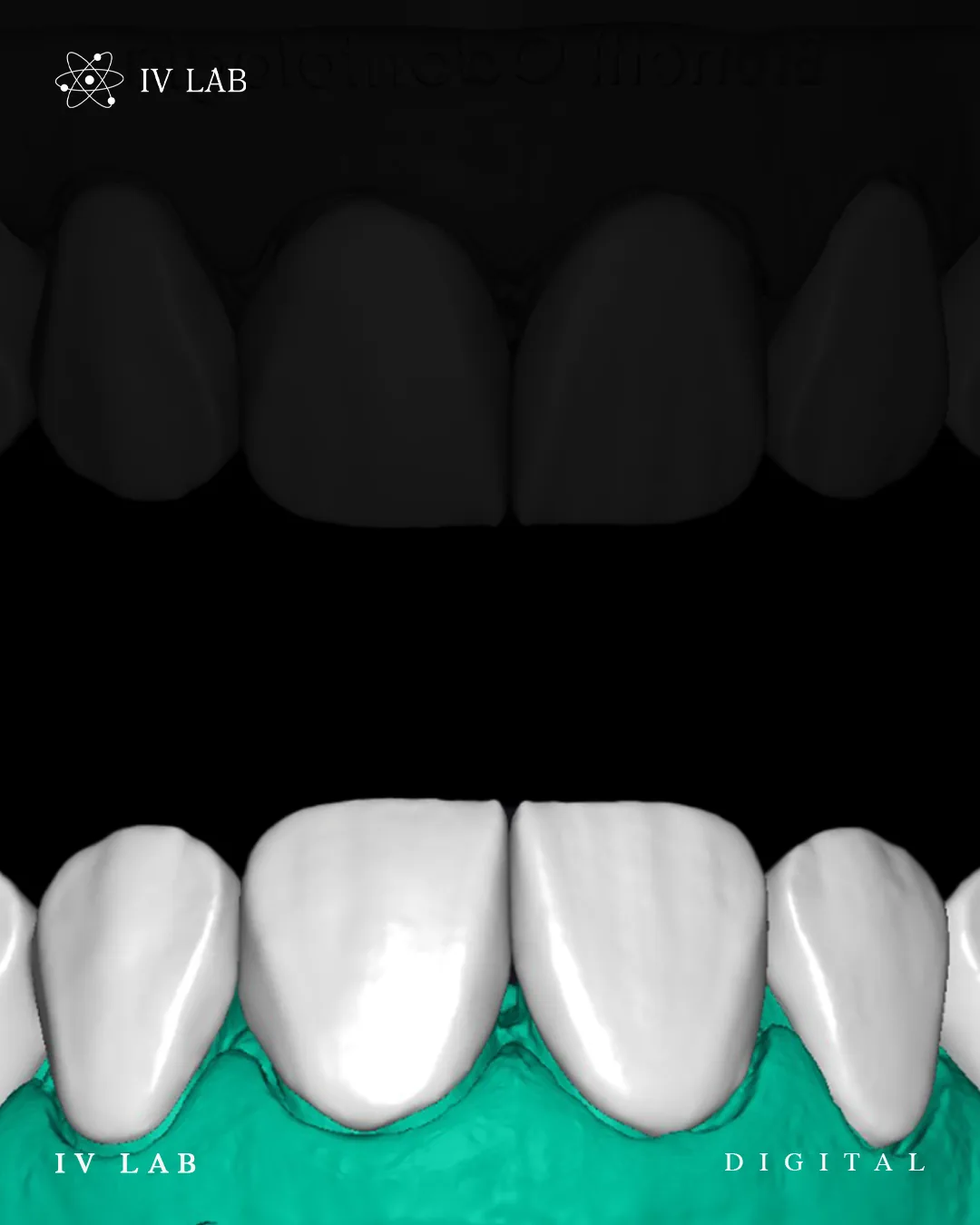 Planejamento digital do sorriso em software