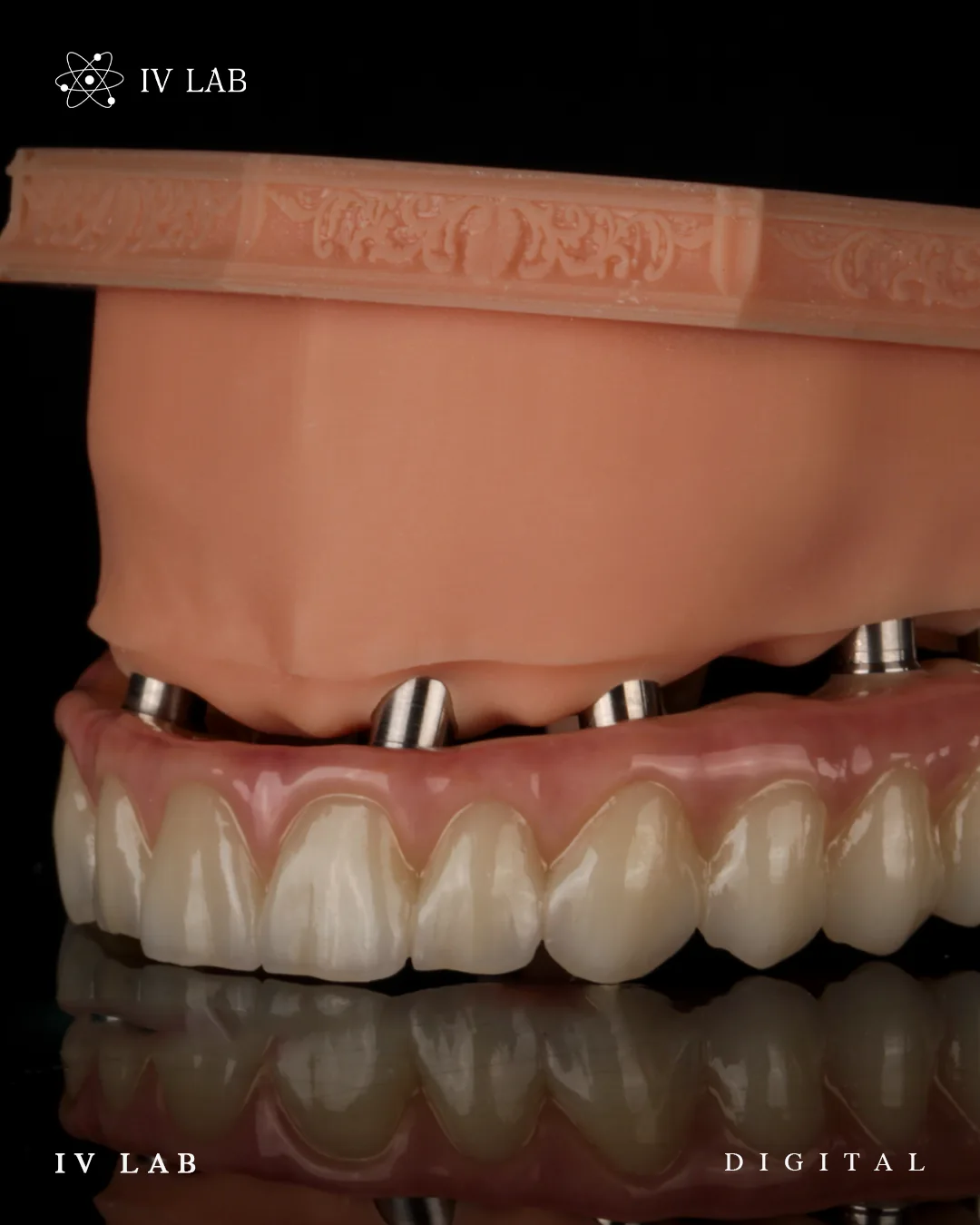 Protocolos laboratoriais sobre implantes